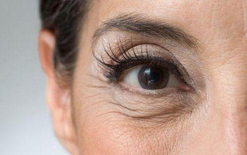 脸有皱纹怎样去除 怎样让脸上的皱纹少一点