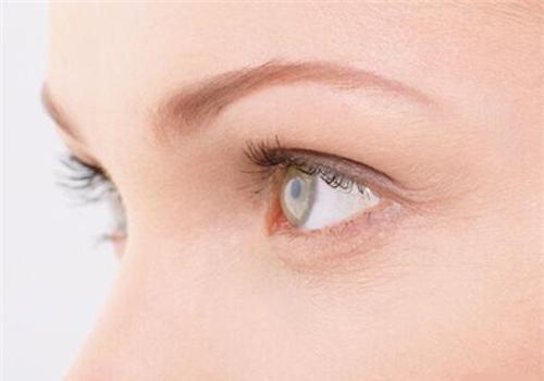 鱼尾纹是怎么形成的 怎样预防鱼尾纹