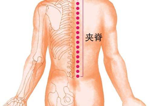 颈椎不好拔罐拔哪里 颈椎病去拔罐好不好