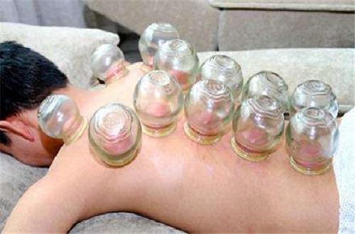 腰部拔罐位置示意图（腰部拔罐位置与功效图）