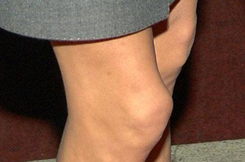 癌症的早期信号 男性癌症的早期信号