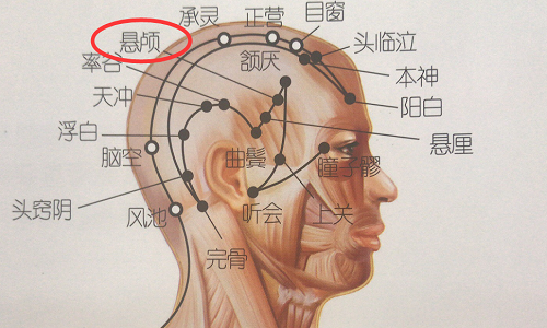 悬颅的准确位置图（悬颅的准确位置图片和视频）