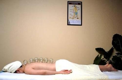 拔罐可以治疗痛经吗(拔罐可以缓解痛经吗)