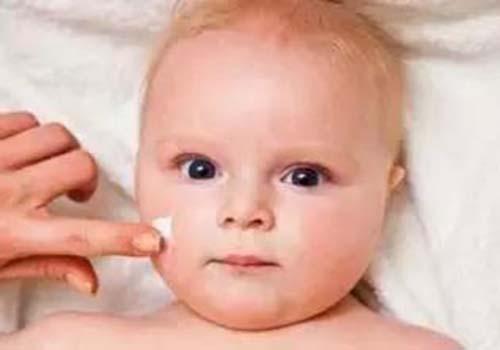 得了湿疹可以喂奶吗（得了湿疹能喂奶吗）