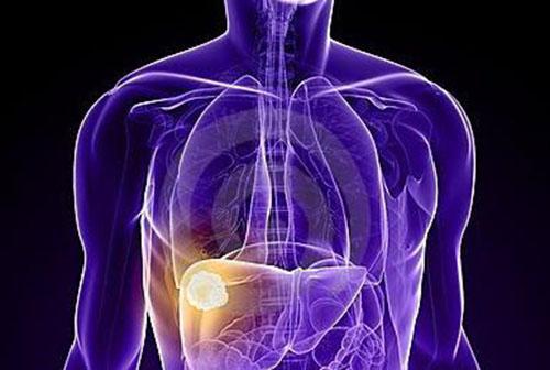 脂肪肝能吃肝吗 脂肪肝能吃猪肝吗