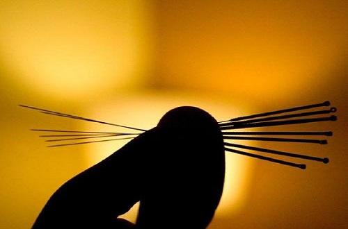 胃疼针灸哪个位置 针灸胃部疼痛怎么回事