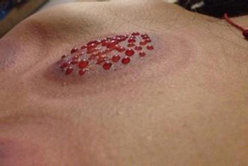 拔罐后罐印长时间不退怎么回事 拔罐后的印长时间不下去