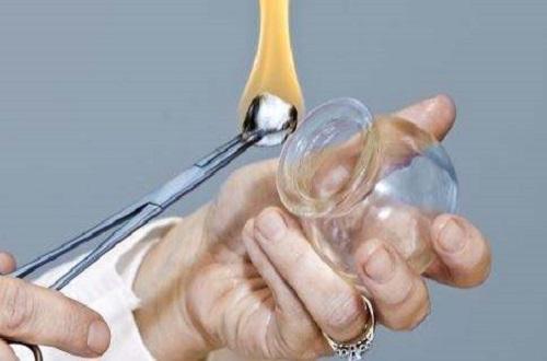 网球肘拔罐怎么治疗 拔罐能治网球肘吗