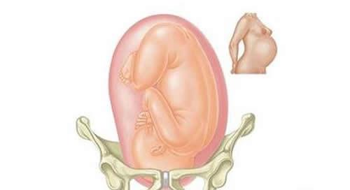 胎儿没入盆能顺产吗 胎儿没有完全入盆可以顺产吗