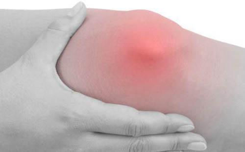 关节炎是怎么引起的(类风湿性关节炎是怎么引起的)