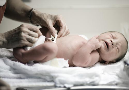 新生儿脐带有点化脓怎么办（新生儿的脐带有点化脓怎么办）