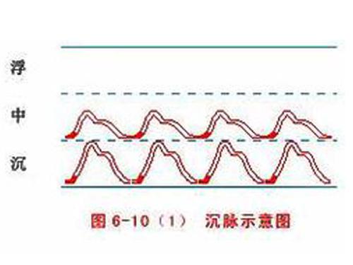 脉象沉是什么意思 脉象很沉是什么意思