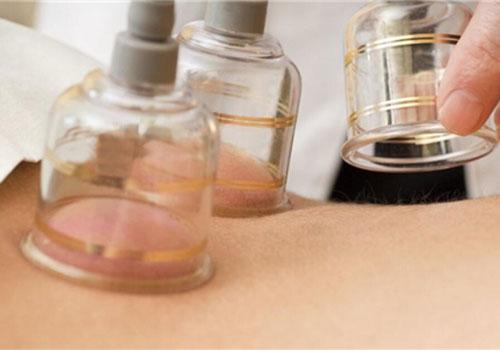 拔罐多长时间可以洗澡 刮完痧拔罐多长时间可以洗澡