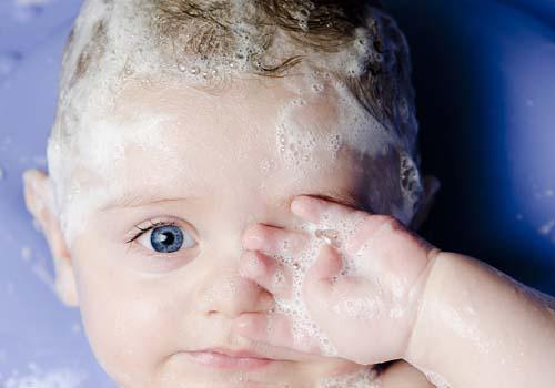 宝宝出生9天肚脐有点出血怎么办 出生九天的宝宝肚脐出血了怎么回事