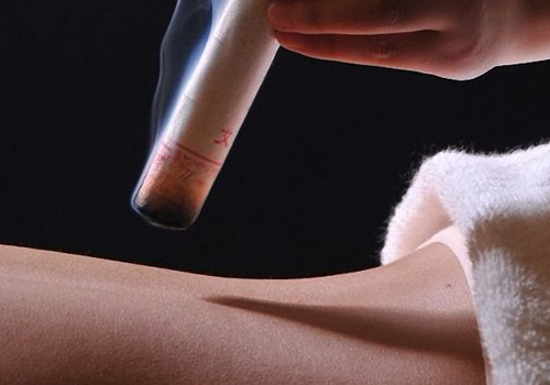 先拔罐好还是先艾灸好(艾灸前拔罐好还是不拔罐好)