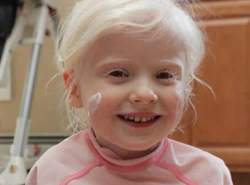 冬天宝宝皮肤干燥怎么办(冬天宝宝皮肤干燥怎么办呢)