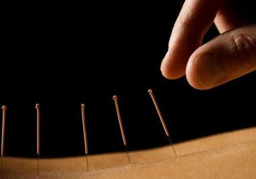 自闭症可以针灸吗(自闭症可以针灸治疗吗)