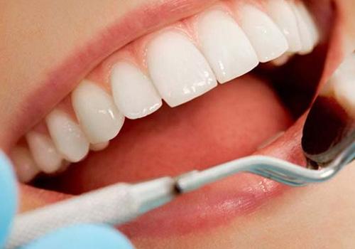 洗牙对牙齿好吗 洗牙有什么好处