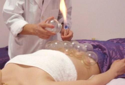 腹痛拔罐治疗方法 腹痛拔罐应拔哪里