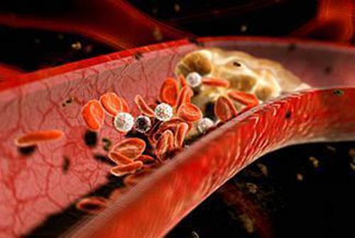 甘油三酯高和胆固醇高的区别（甘油三酯高和胆固醇高有啥区别）