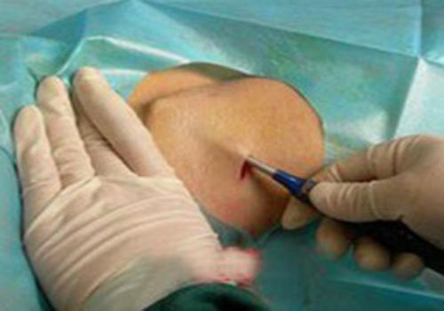 狐臭的味道像什么味道 狐臭的味道是什么味道