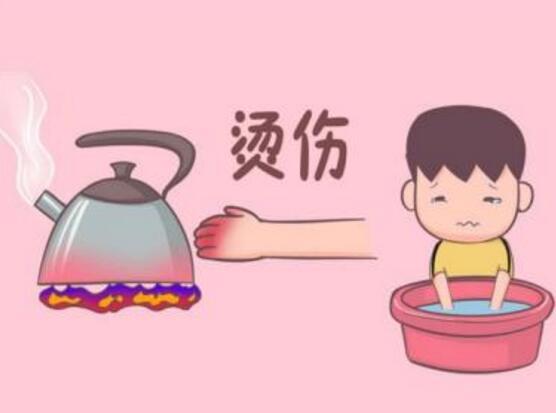 儿童烫伤应怎么处理 儿童烫伤的处理方法
