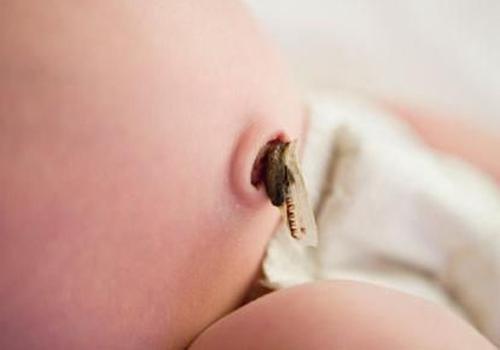 宝宝脐带一个月还没掉怎么办（宝宝脐带一个月了还没掉怎么办）