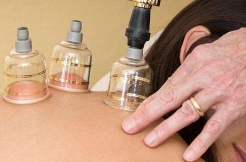 感冒拔火罐有用吗（风热感冒拔火罐有用吗）