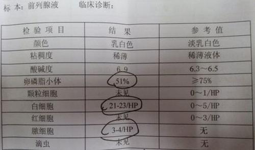 前列腺炎化验单怎么看 十秒看懂前列腺检验单
