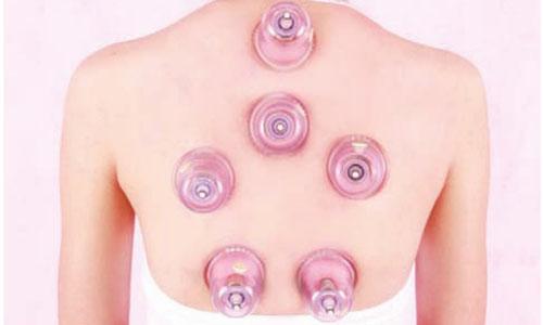 甲亢可以拔罐吗 甲亢拔罐拔什么位置