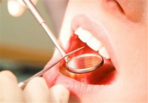 拔智齿可以瘦脸吗 拔智齿可以瘦脸吗 骨骼图