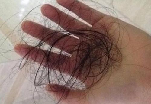 洗头掉头发是什么原因 洗头掉头发是什么原因引起的