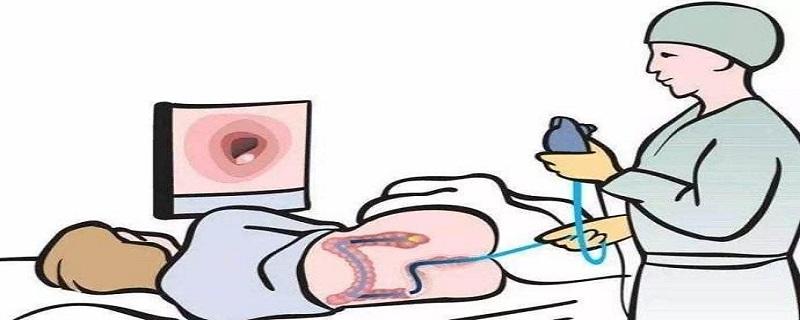 直肠癌要检查什么项目(直肠癌需要做什么检查)