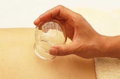 拔罐和刮痧哪个效果好（拔罐好还是刮痧好）