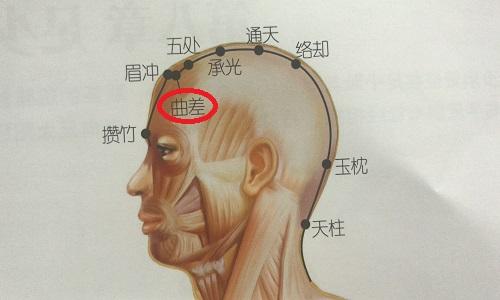 曲差的准确位置图 曲差的准确位置图作用