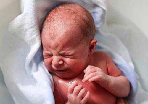 小孩得了湿疹不吃饭怎么办(宝宝湿疹可以吃饭)