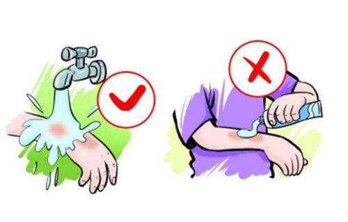 烫伤后的正确处理方法（蒸汽烫伤后的正确处理方法）