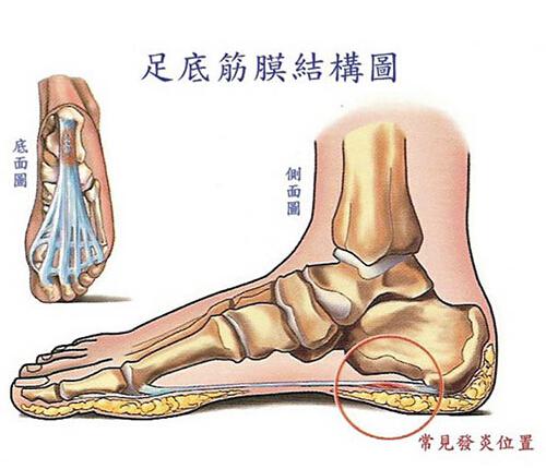 脚跟底部疼是怎么回事 脚跟底部痛是怎么回事