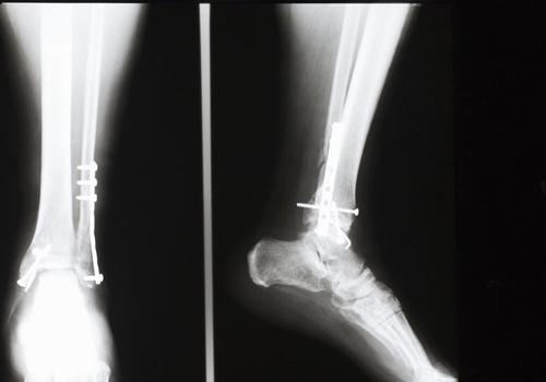 吹空调小腿酸痛什么病（吹空调小腿酸痛是怎么回事）