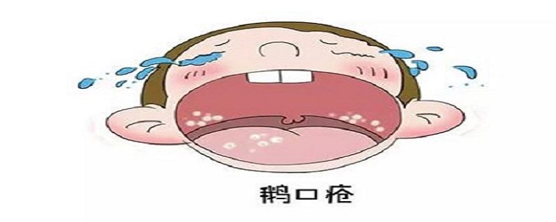 小儿鹅口疮艾灸哪里（）