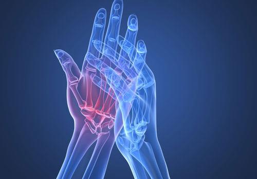 类风湿性关节炎应该注意什么（风湿性关节炎应注意哪些）