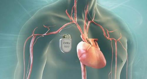 什么人容易得高血压（什么人容易得高血压高血糖）