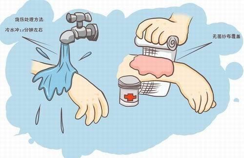 烫伤急救措施及步骤(烫伤急救措施及步骤有哪些)