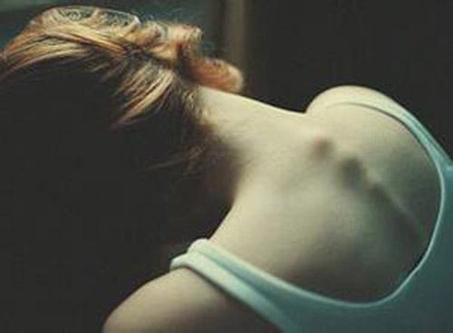 颈椎病有哪些症状 颈椎病并不只有脖子痛