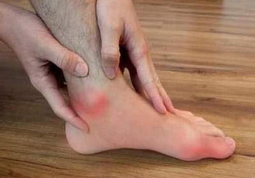 痛风高血压吃食谱大全(痛风高血压饮食)