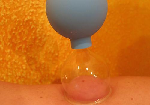 拔罐能调理哪些疾病 拔罐可以调理身体什么疾病