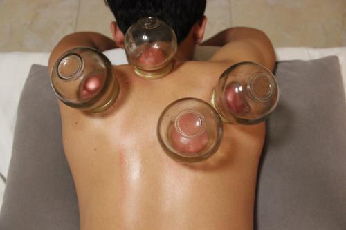 拔罐的作用(拔罐的作用及适用范围)