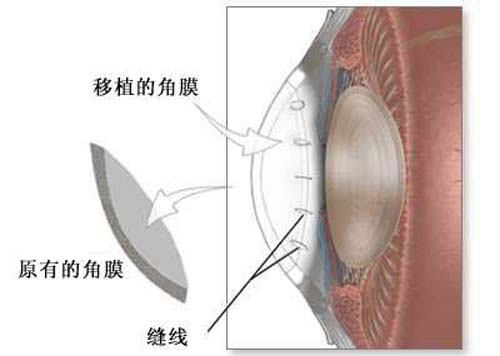 眼角膜是什么（眼角膜是什么颜色）