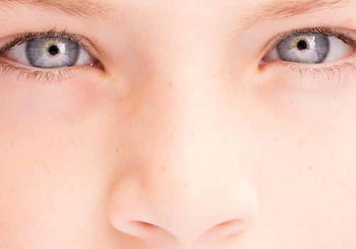 冬天鼻子干燥脱皮（冬天鼻子干燥脱皮是什么肤质）