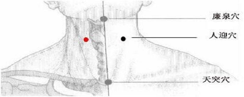 人迎针刺方法 针刺人中的方法